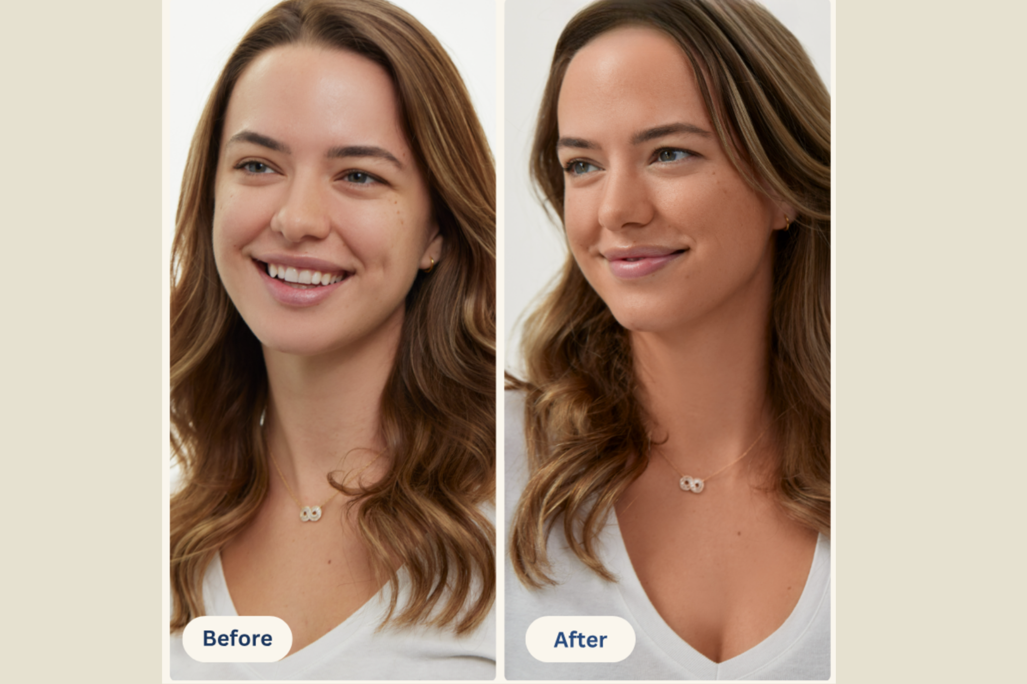 Mimosa Lane result