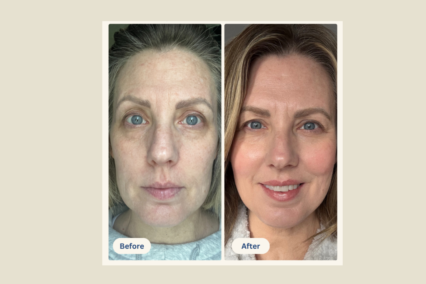 Mimosa Lane before and after result