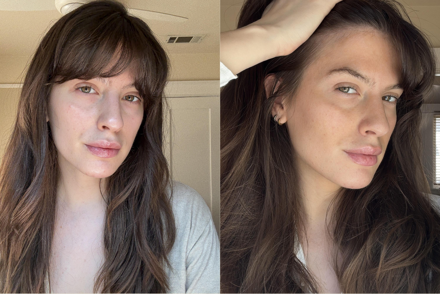 Mimosa Lane face before and after